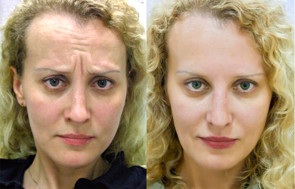 before and after using the rejuvenating massager ltza photo 1